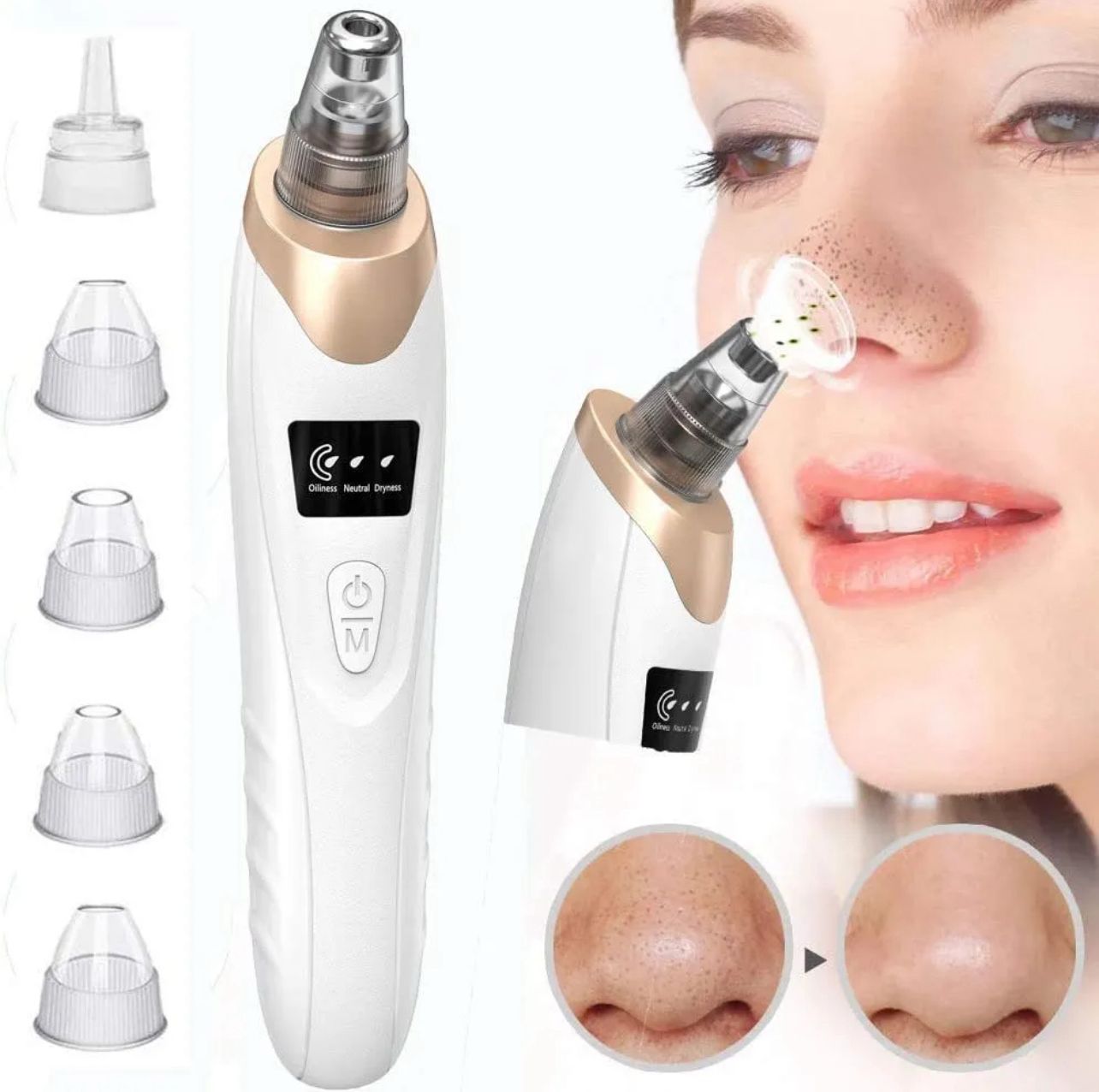 5-in-1 Rechargeable Pore Cleaner | Powerful Blackhead Remover with Derma Suction