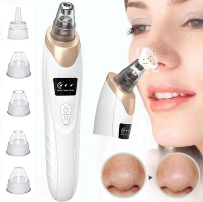 5-in-1 Rechargeable Pore Cleaner | Powerful Blackhead Remover with Derma Suction