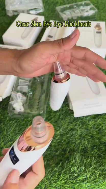 5-in-1 Rechargeable Pore Cleaner | Powerful Blackhead Remover with Derma Suction